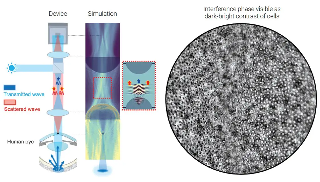 Optical imaging technique for the anterior segment of the eye showing transmitted and scattered light used to visualize corneal cellular structures.
