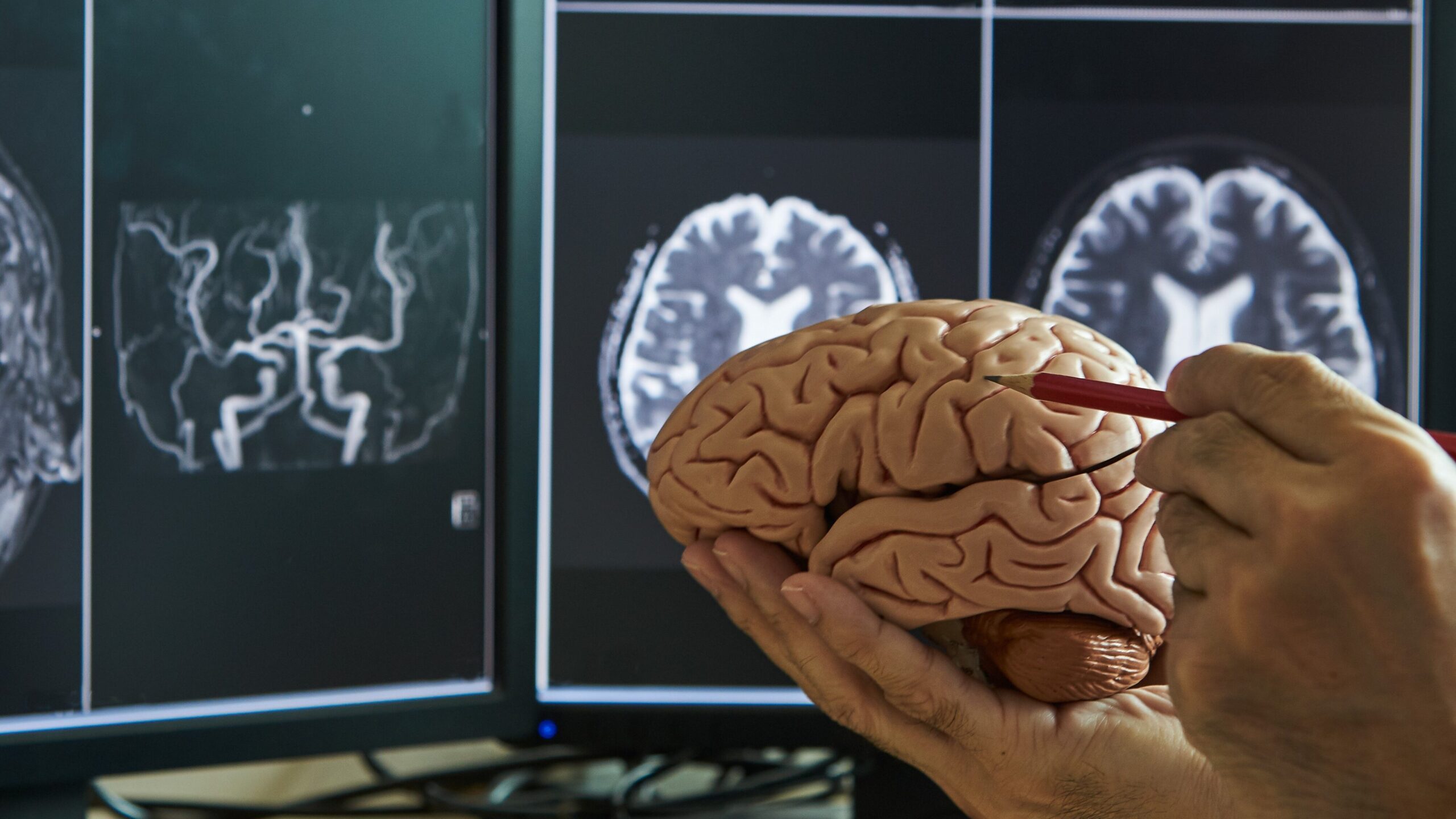 A medical professional holds a detailed anatomical model of a human brain while pointing at a specific region with a red pencil. In the background, two computer monitors display MRI brain scans with various cross-sectional images of the brain’s structure and blood vessels. The setting suggests a neurology or radiology environment.