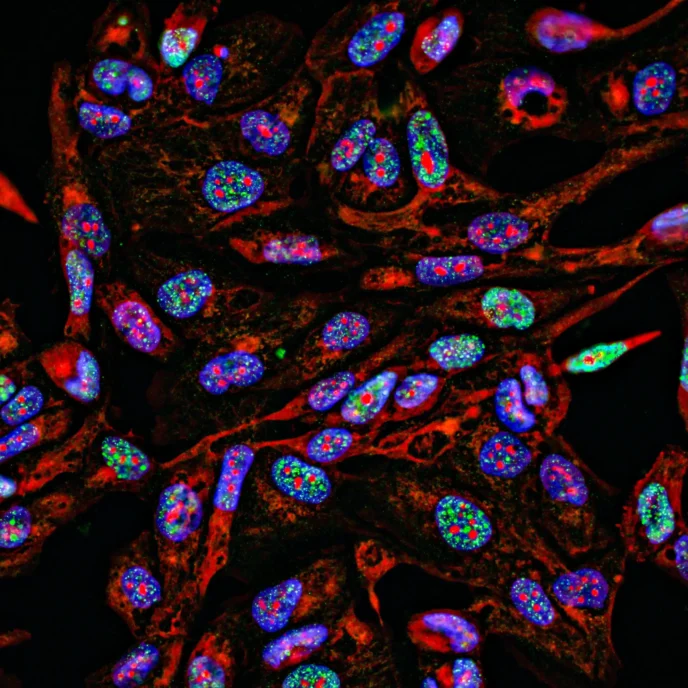 Fluorescent Imaging immunofluorescence of cancer cells growing in 2D with nuclei in blue, cytoplasm in red and DNA damage foci in green