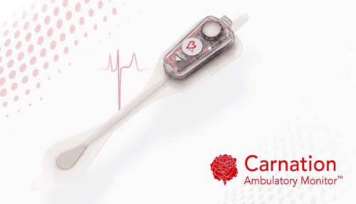 Rendered image of the Carnation Ambulatory Monitor on a white background with ECG graphic and Carnation Ambulatory Monitor branding.