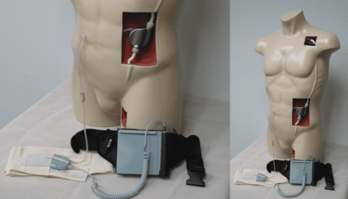 Mannequin torsos demonstrating placement of the LVAD recovery system controller and connected tubing for clinical setup simulation.