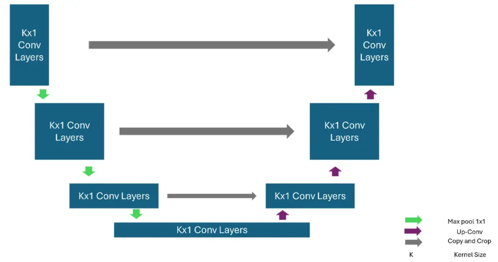Modified 1D U-Net architecture for AI ECG arrhythmia detection model with encoder-decoder structure and skip connections