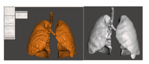 functional models from anatomical scans 