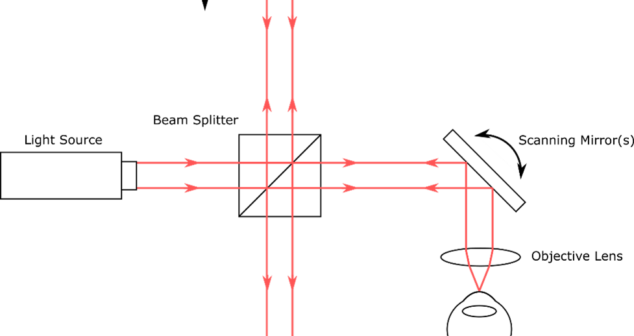 Optical Coherence Tomography Types