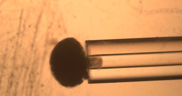 Micropipette Aspiration