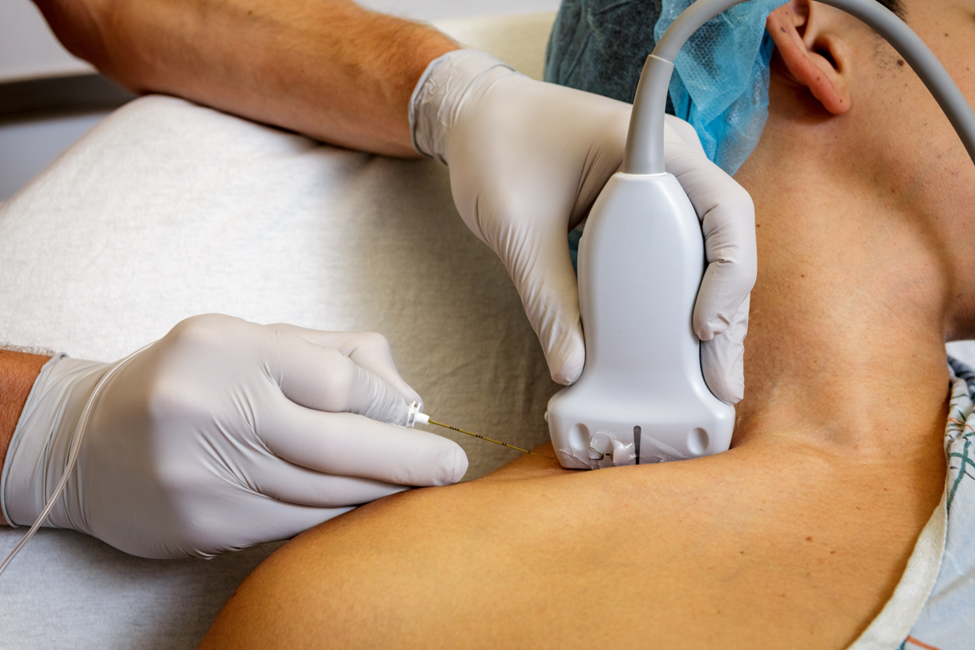 A gloved hand holding a transducer and another hand holding a needle right under the transducer.