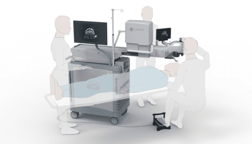 Rendered image of the LENSAR ALLY cataract treatment system in a clinical setup with silhouettes showing patient and clinician positioning.
