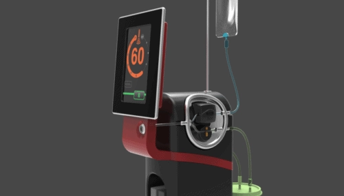 Rendered view of the Misonix Nexus device showing the touchscreen console connected to the ultrasonic handpiece and cable assembly.