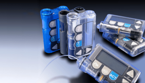 Close-up image of MiniMed insulin pump battery compartments and AAA batteries arranged alongside device components.