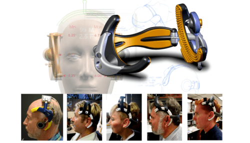 Composite image showing the Trans Cranial Doppler device on a head model with several smaller photos demonstrating different prototype test fits.