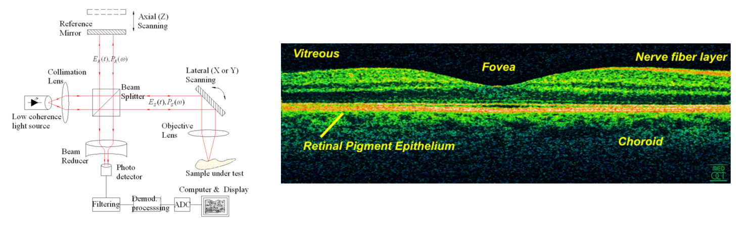 Revolutionizing Medical Imaging Devices with Optical | StarFish Medical