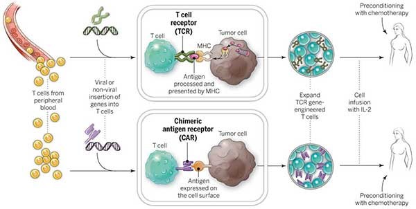 CAR-T Chart showing how T cells are sourced from a patient, genes are inserted, and the cells are returned to the patient. Credit: The National Cancer Institute.