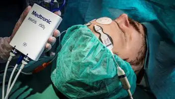 Cerebral rSO2 monitoring system using near-infrared spectroscopy for regional brain oxygen saturation during surgery.