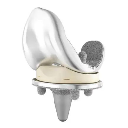 DePuy Graduated Compartmental Knee (GCK)