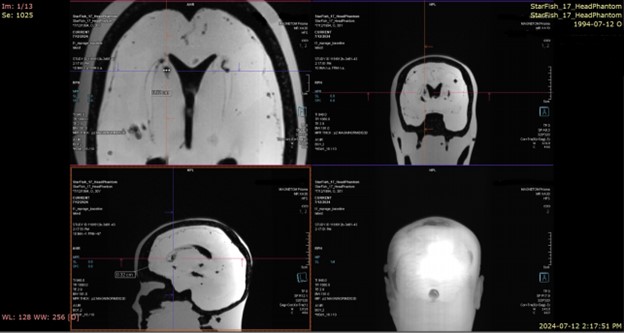 Four different cross-sections of the plastic skull that was used to support testing and development.