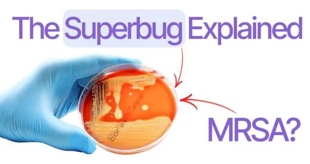 A gloved hand holding a petri dish with bacterial growth, illustrating the MRSA superbug explained in a Bio Break episode