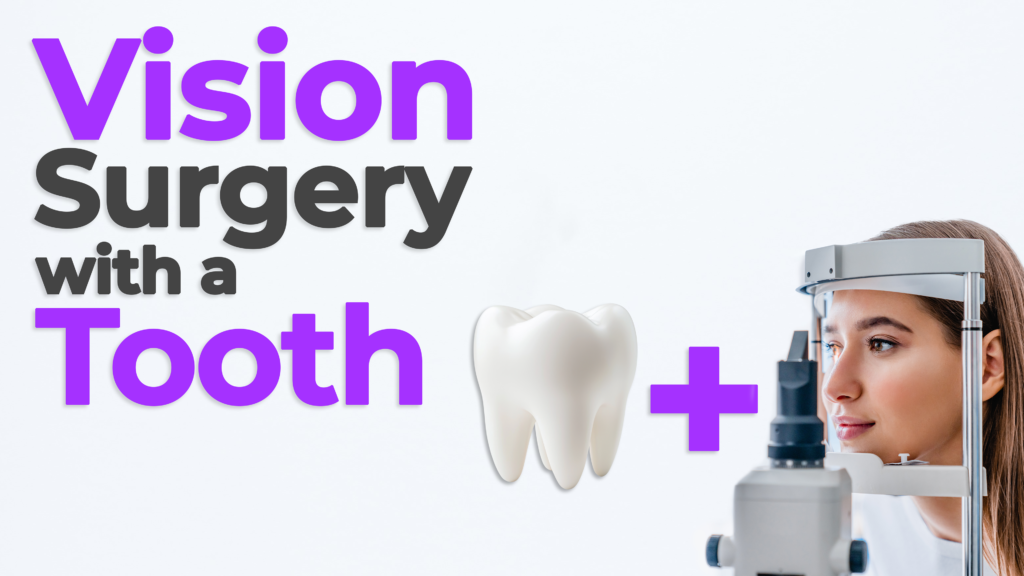 A promotional graphic with bold text reading "Vision Surgery with a Tooth" in purple and black letters. Below the text is a large 3D image of a tooth and a purple plus sign. On the right side, a woman is undergoing an eye exam using a slit lamp microscope.