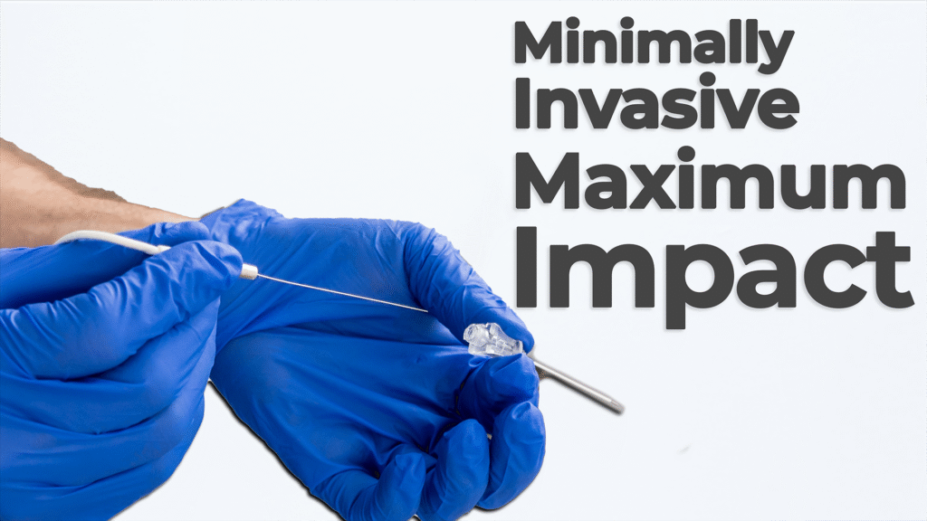 Close-up of gloved hands holding a medical catheter with the text "Minimally Invasive Maximum Impact" on the right side, representing advanced medical device technology.