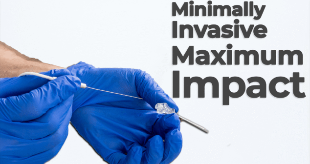 Close-up of gloved hands holding a medical catheter with the text "Minimally Invasive Maximum Impact" on the right side, representing advanced medical device technology.