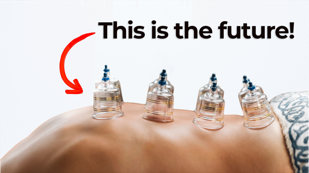 Cupping therapy on a person's back with six transparent suction cups applied to the skin. A bold text reads 'This is the future!' with a large red arrow pointing toward the cups. The background is minimal and white.
