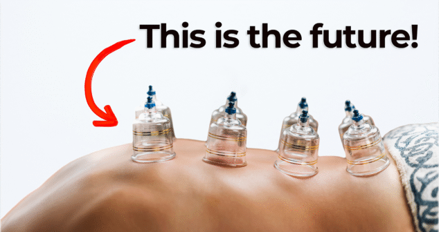 Cupping therapy on a person's back with six transparent suction cups applied to the skin. A bold text reads 'This is the future!' with a large red arrow pointing toward the cups. The background is minimal and white.