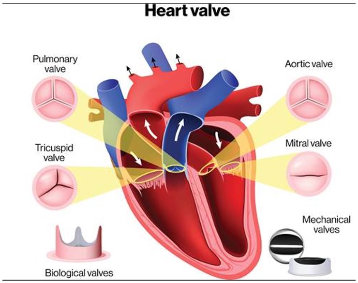 A diagram of a heart showing the pulmonary, aortic, tricuspid, and mitral valves and their locations. 