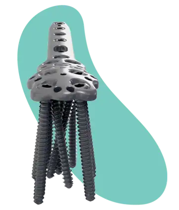 Smith & Nephew Variable-Angle Locking Mini-Fragment Plating System
