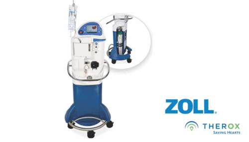 Rendered image of the intravascular thermography diagnostic system including the cart, monitor, catheter interface and controls.